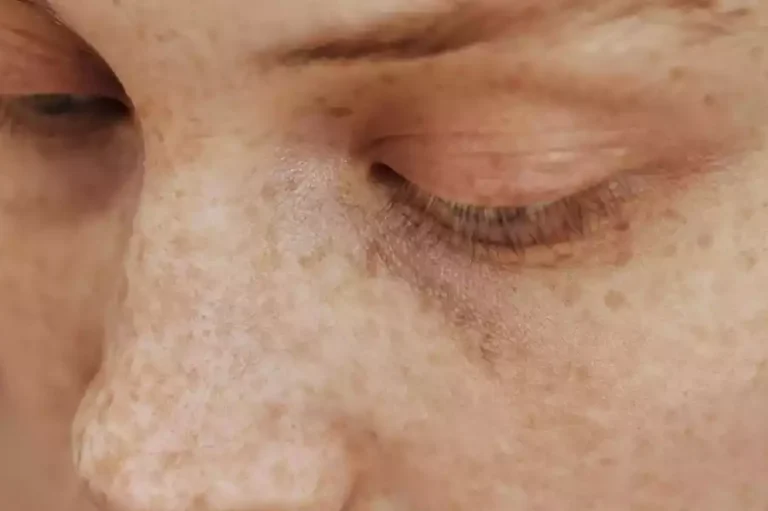 Un compuesto más potente que el retinol: Aliado de la piel